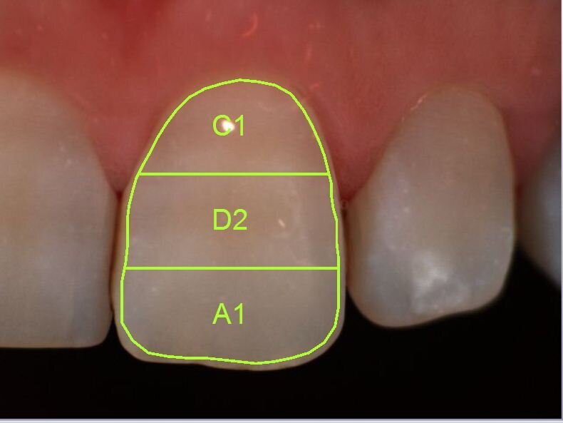 Fig. 3b