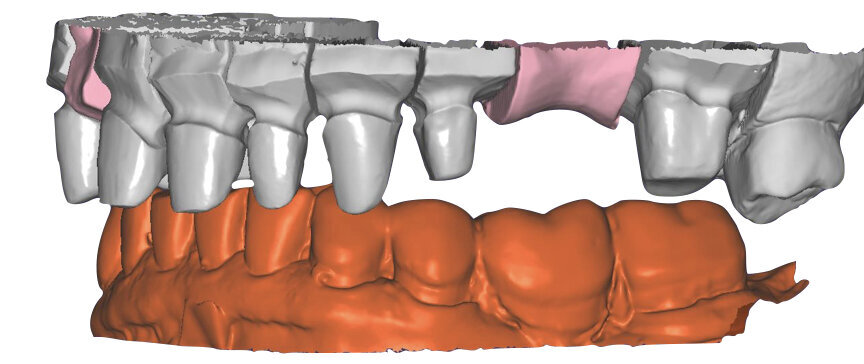 Fig. 57