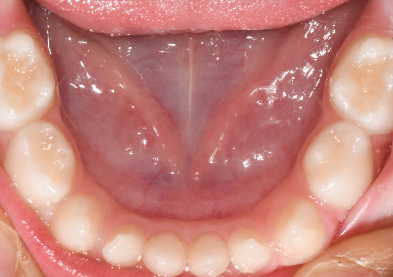 Fig. 1d