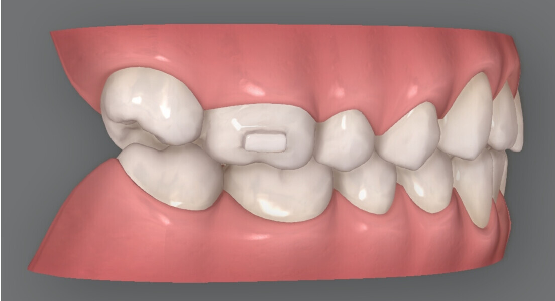 Fig. 7b