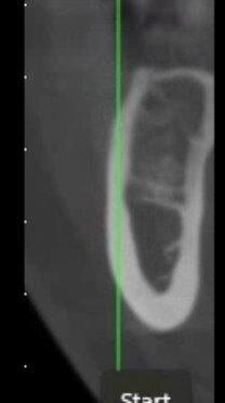 Fig. 3b