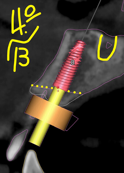 Fig. 5d