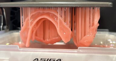 Leading the charge with 3D-printed prostheses