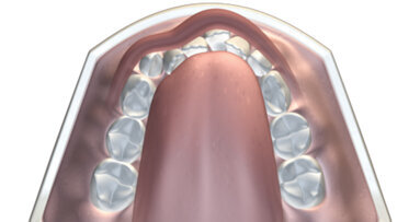 Myofunctional orthodontics and myofunctional therapy