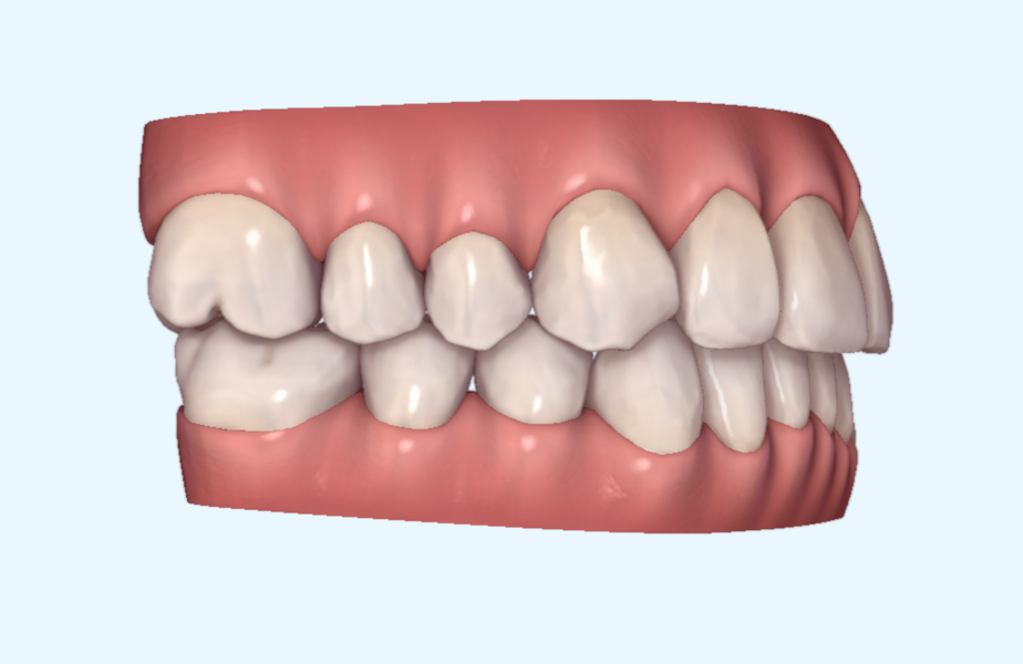 Fig. 21b