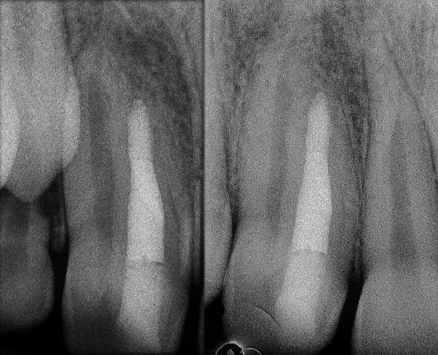 Figure 37