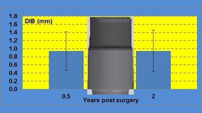 Performance clinique et radiologique des implants courts (L 6,5 mm). Résultats d’une étude clinique incluant un suivi de 2 ans