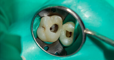 Hybrid shaping with MG3 rotary system