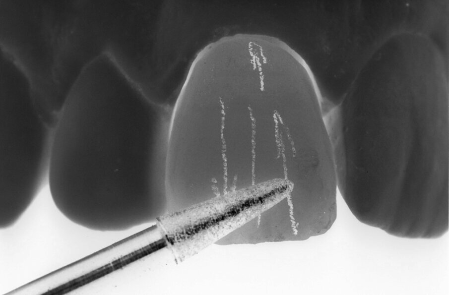Fig. 13 - Creazione di linee verticali di diversa lunghezza.