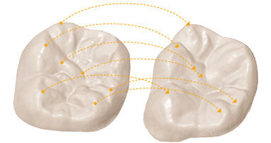 CEREC Biogeneric: now for crowns, veneers and anatomical bridges