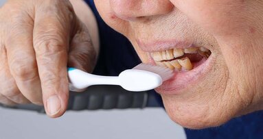 Report calls for better training in oral healthcare for retirement home staff