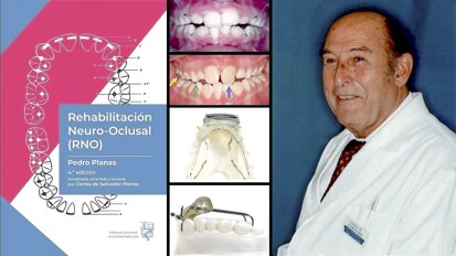 Por una actualización de la Rehabilitación Neurooclusal de Pedro Planas