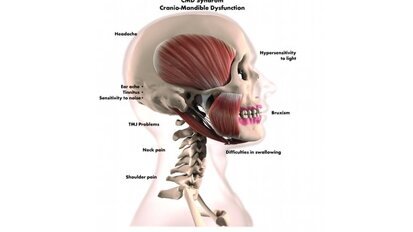 L’importance de l’occlusion