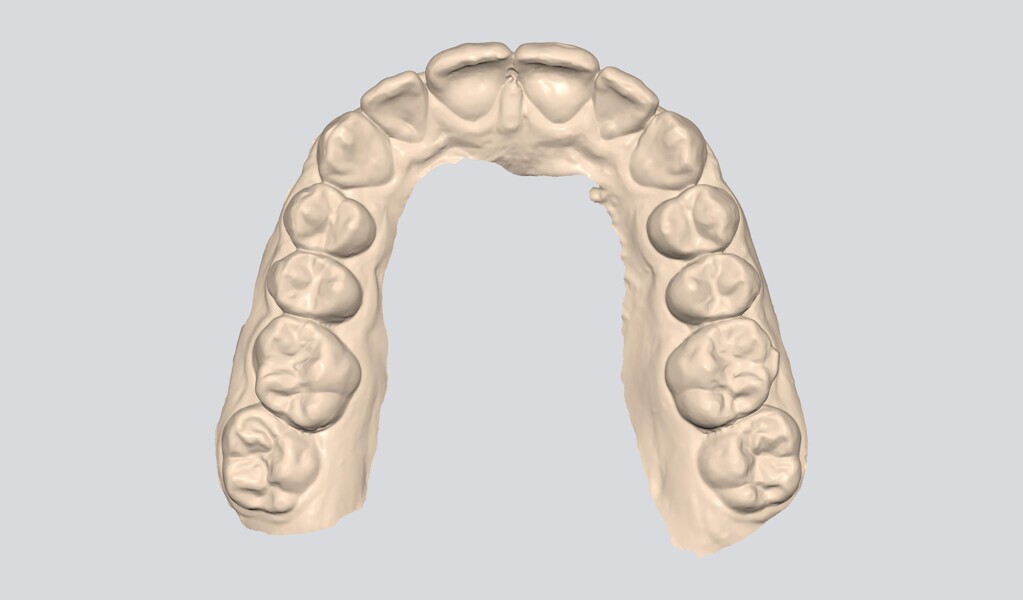 Fig. 17