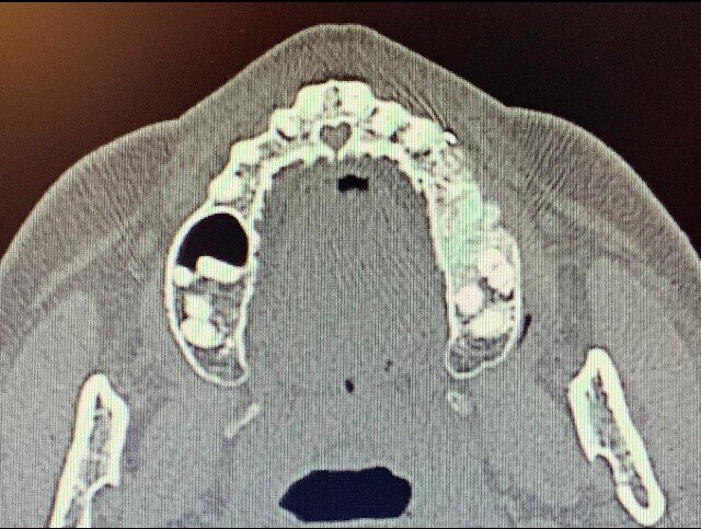 Fig. 22