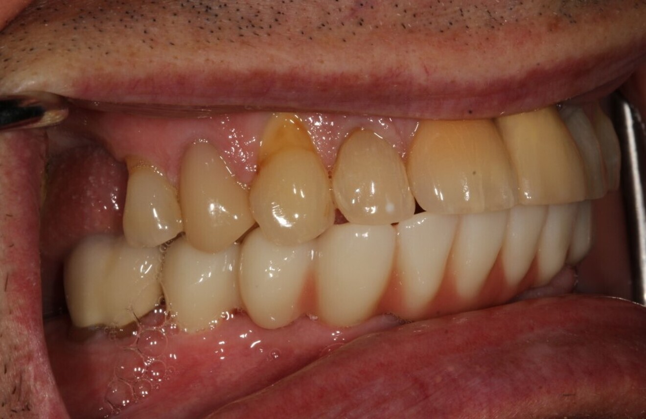 Fig. 18b.