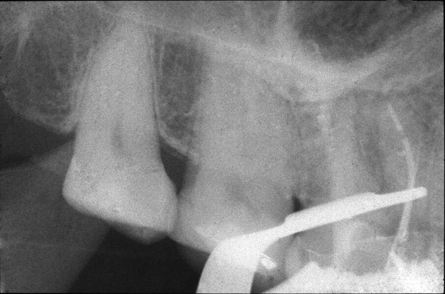 Fig. 1b