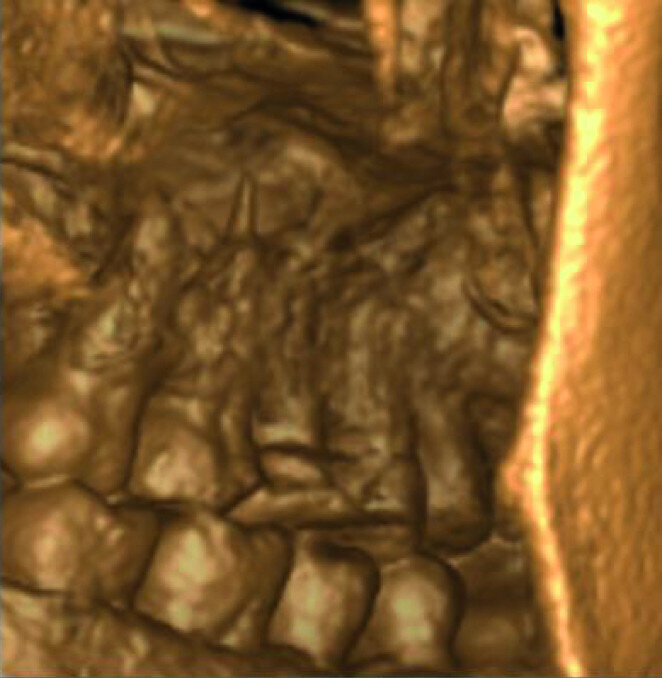 Fig.: 9