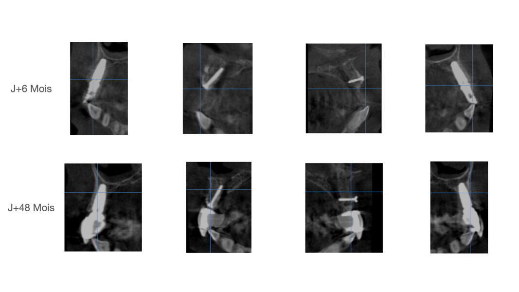 Fig. 39