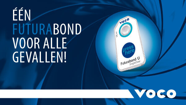 Futurabond U – één 'Bond' voor alle gevallen
