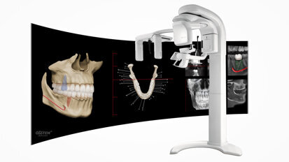 Osstem’s OneGuide makes implant surgery easy, convenient and safe even in difficult cases