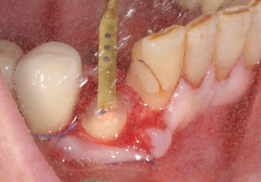 Fig. 3