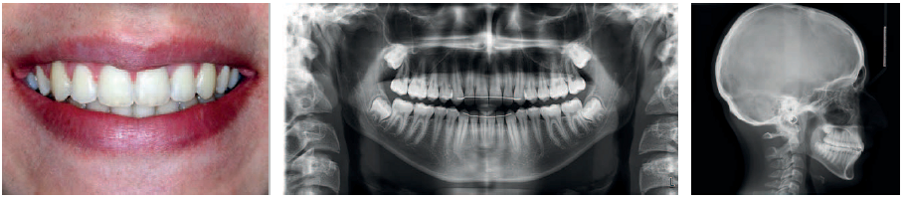 Case01_15