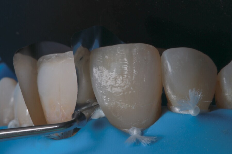 Fig. 5b
