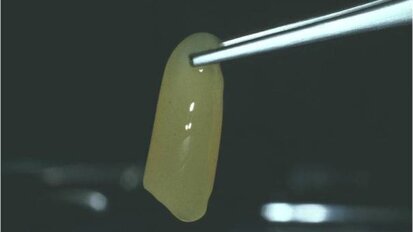 In Odontoiatria sono legali i fattori di crescita piastrinici autologhi?