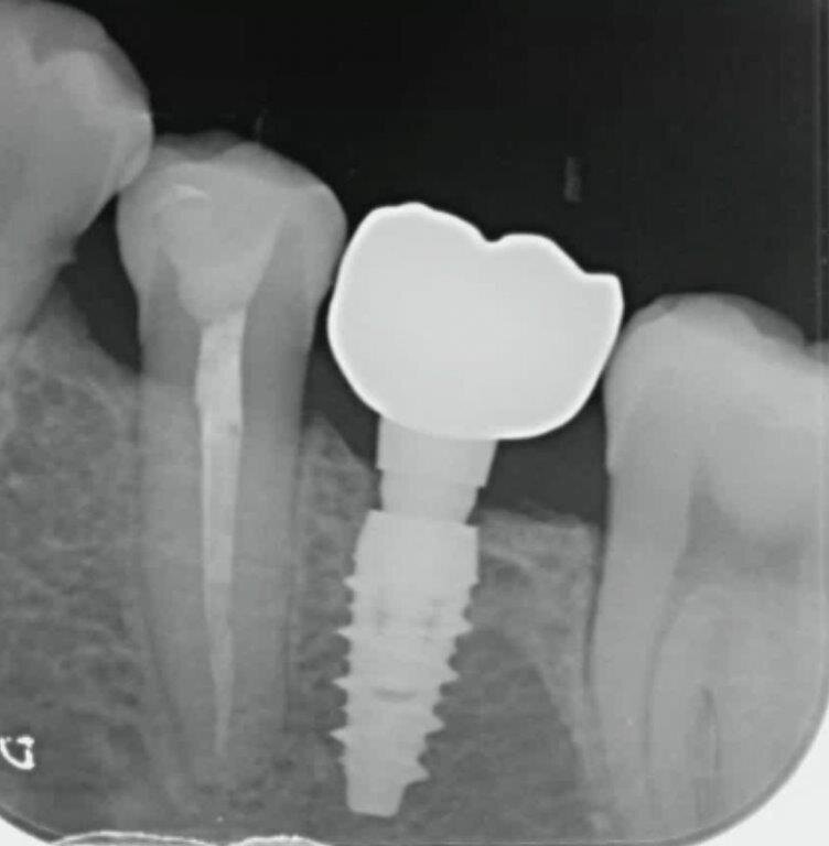 Fig. 3d