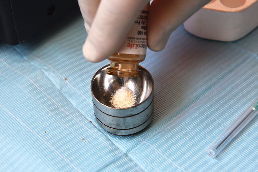 Fig. 11: Allograft (cortical, cancellous or a mixture of the two) is dispensed from the bottle into a sterile dish.