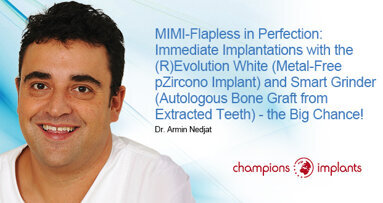 Extraction and implantation in just one session: Expert explains how