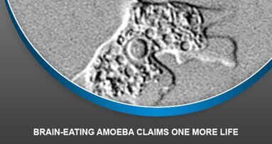 Brain-eating amoeba claims one more life