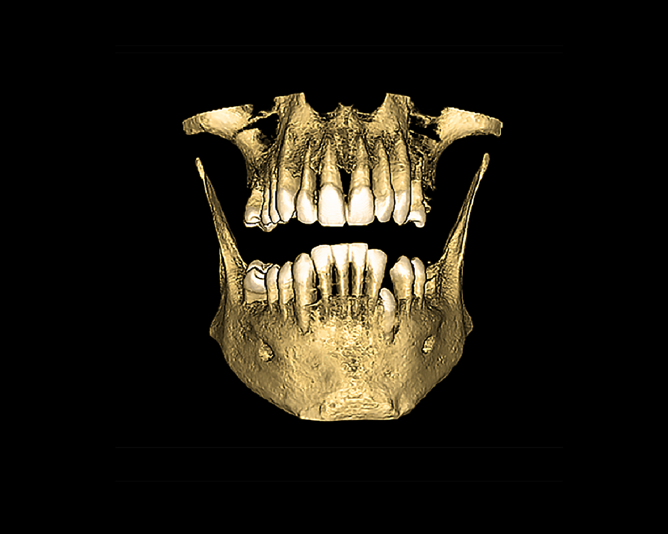 Fig. 11b: CBCT scan for diagnosis and treatment planning. 