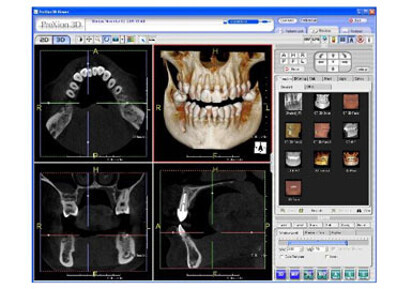 PreXion 3D Viewer