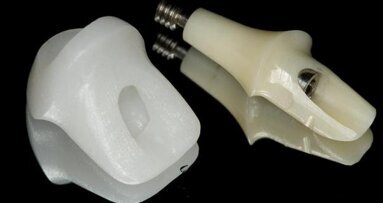 Implantology—the perfect art of camouflage thanks to CAD/CAM