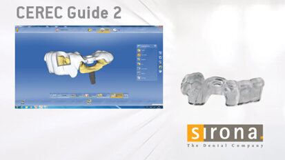 Interventi di implantologia rapidi e semplici con CEREC Guide 2