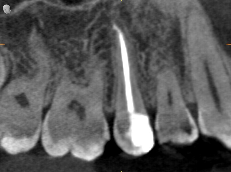 Fig. 21a.