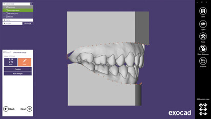 exocad - Ortho