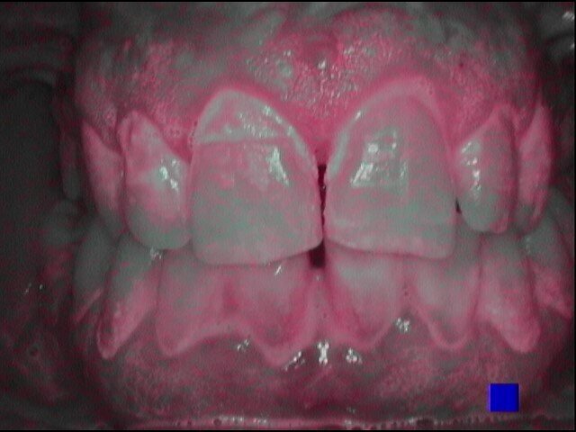 Fig. 2c