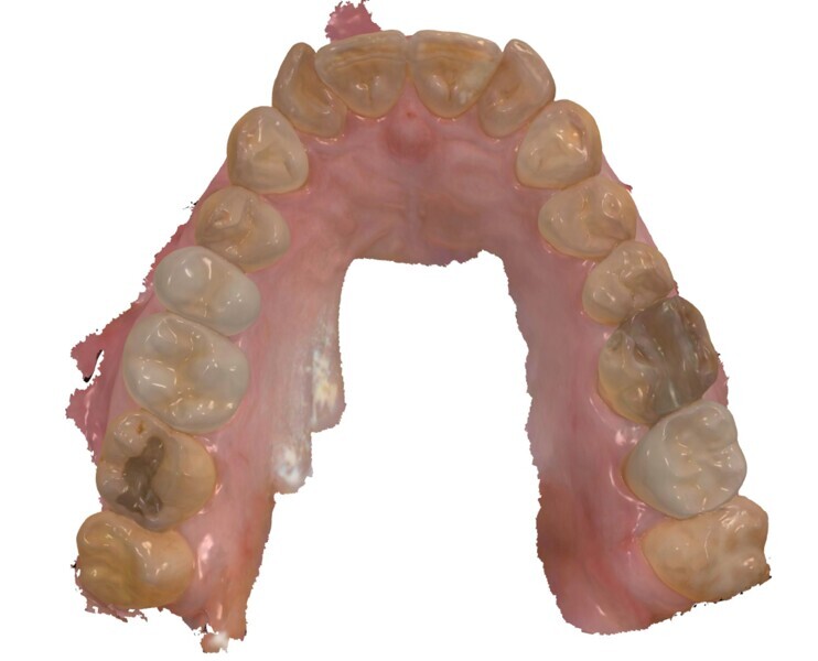 Fig. 4