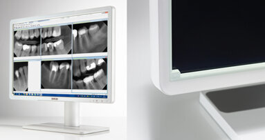 Eonis dental displays: high image quality for fast, accurate diagnosis and dental image review