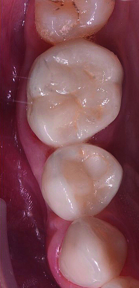 Fig. 1b