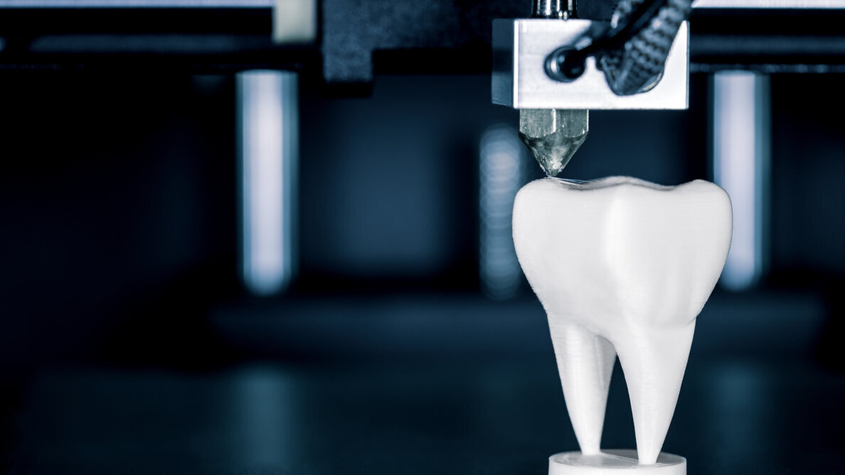Study highlights benefits of in-house 3D printing for immediate dental implant placement