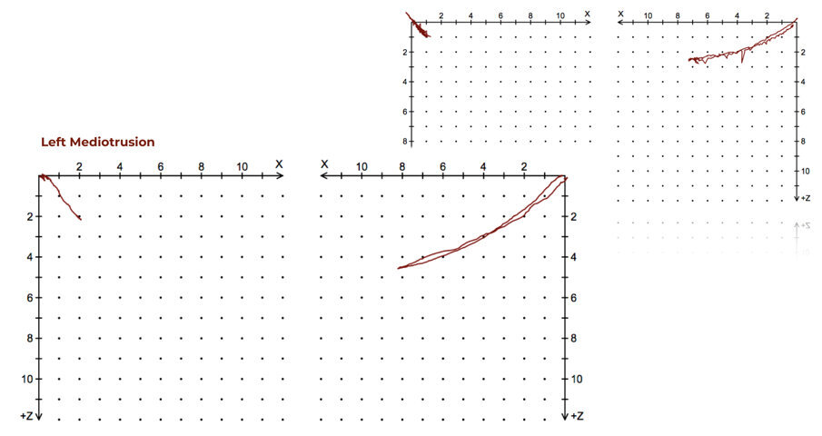 Fig. 45