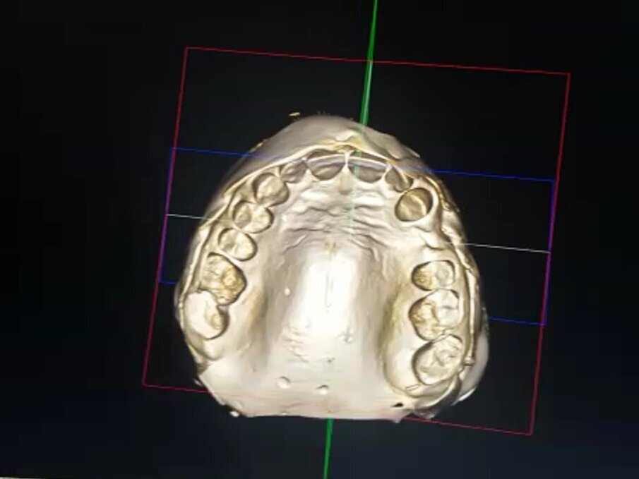 Fig. 6_Immagine ottenuta mediante CBCT.