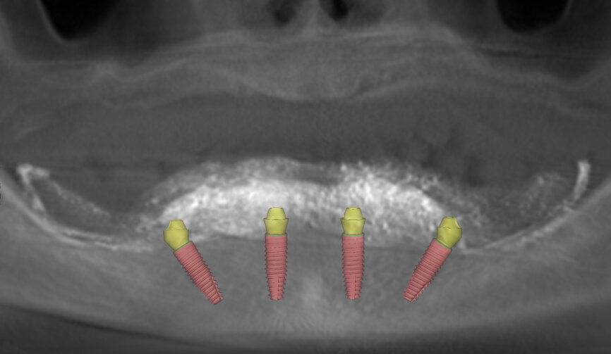 Fig. 4