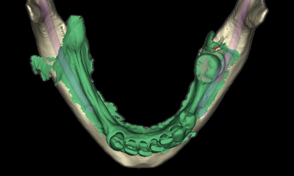 Fig. 17