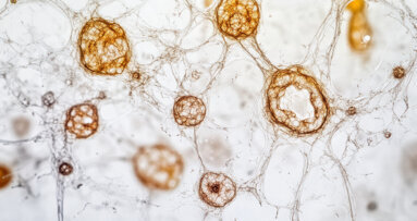 New natural compound therapy shows promise in managing periodontal disease