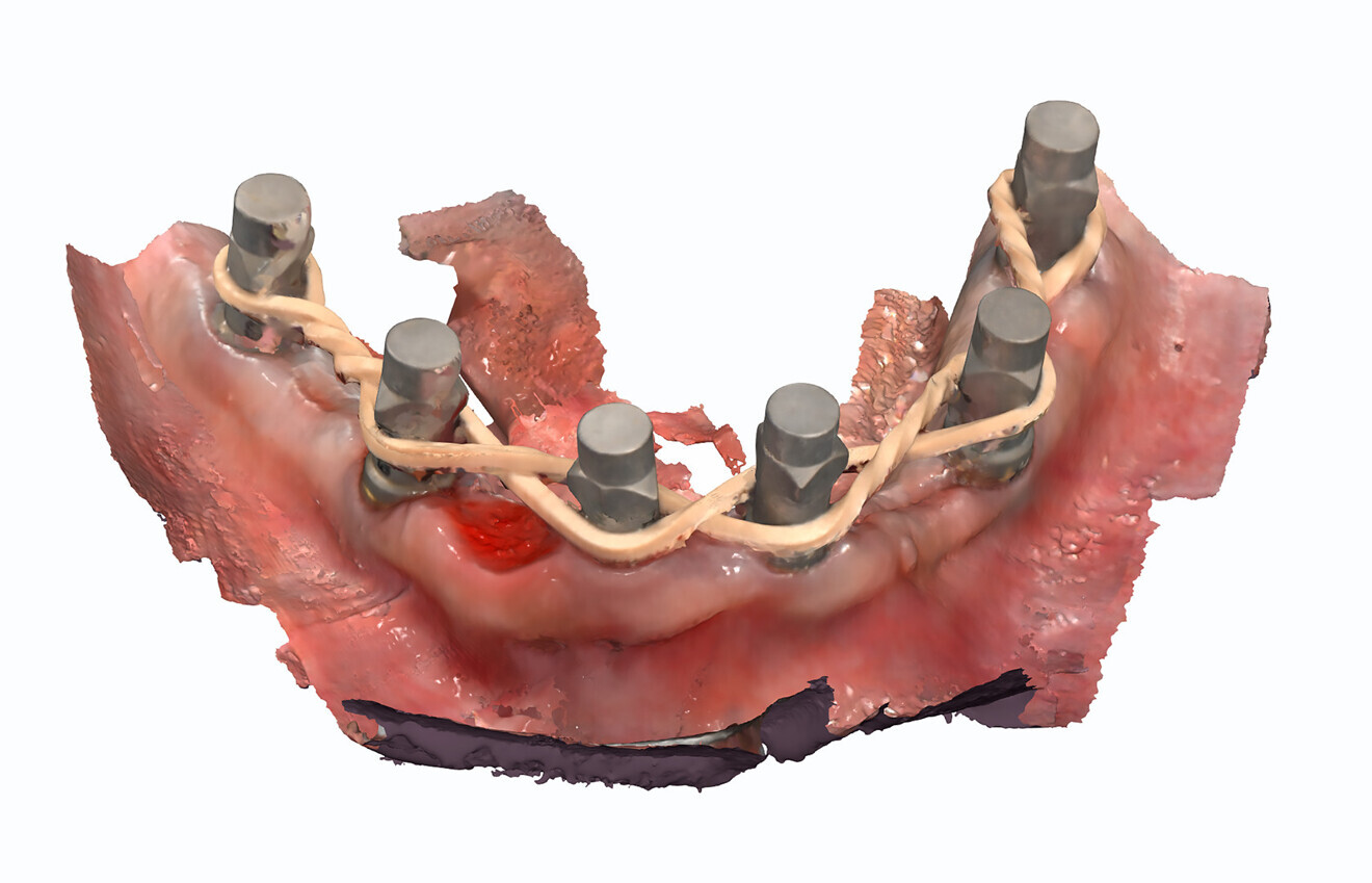 Fig. 1b